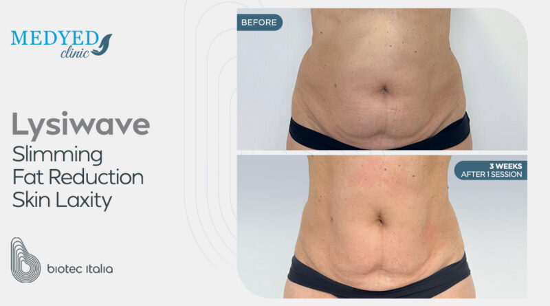عيادة Medyed تجربة شاملة للعلاجات التجميلية والعافية المتقدمة